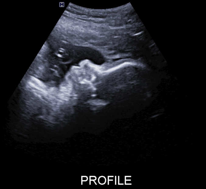 baby profile at 36 weeks