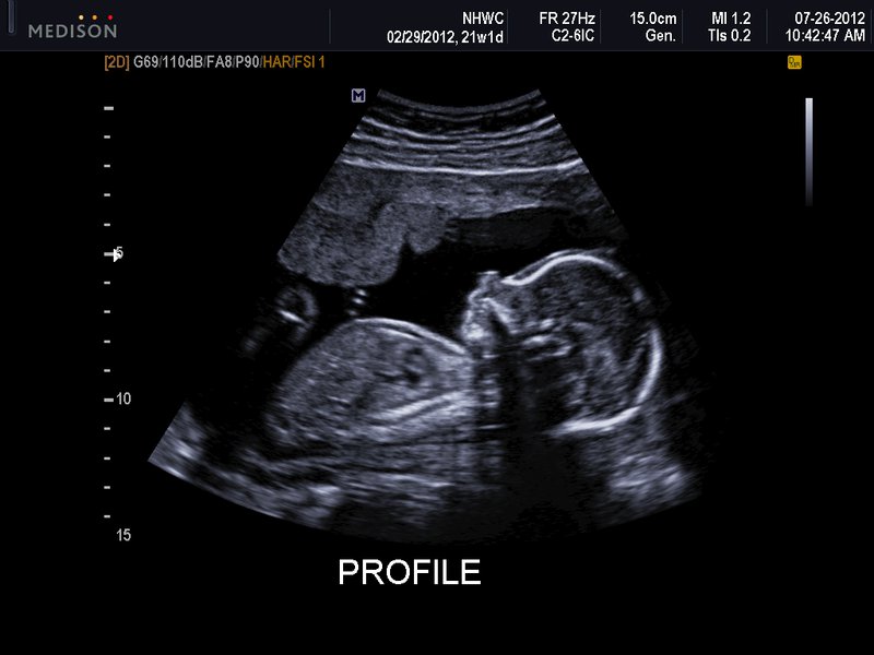 21 week baby ultrasound: profile