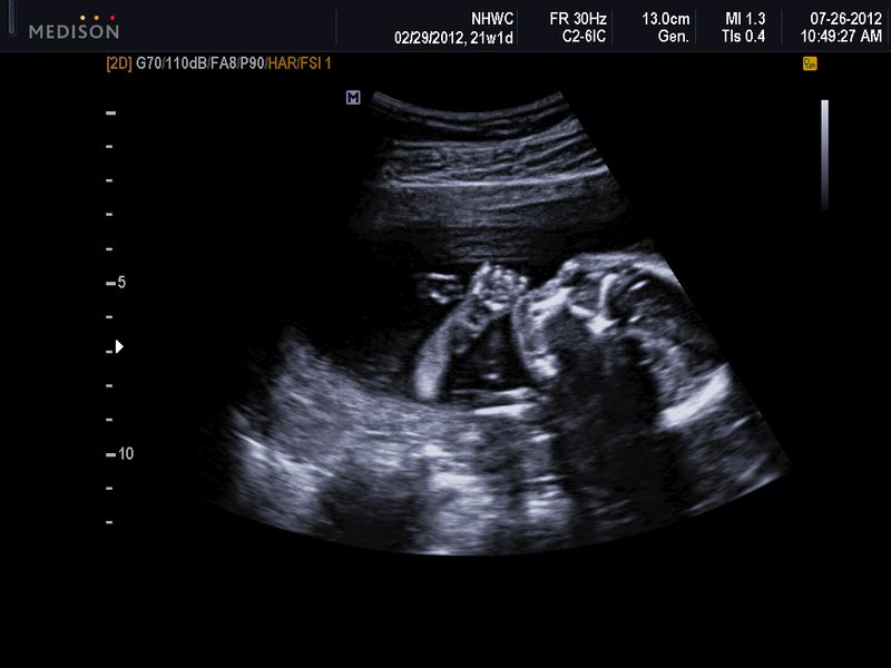 21 week baby ultrasound: sucking thumb