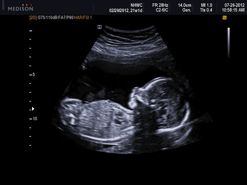 21 week baby ultrasound: full-length profile